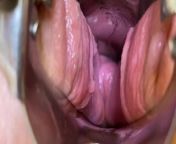 Gynecological retractor! Stretching pussy and fucking myself with a dildo! from naha kaka